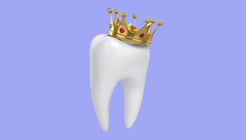 The Benefits of Same-Day Crowns: Quick and Convenient