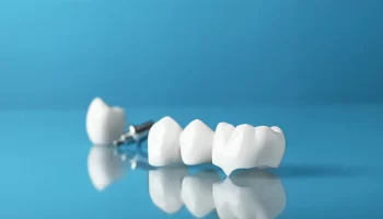 How Same-Day Crowns Help Prevent Future Dental Problems