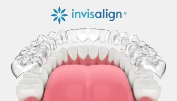 How Invisalign Treatment Supports Better Long-Term Oral Health